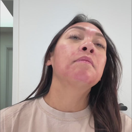 ✨ بشرة مُشعة.. بلا عيادة، بلا ألم، وبلا انتظار